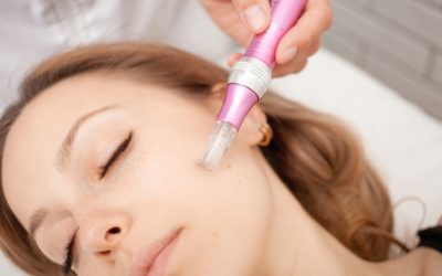 What Does Micro-Needling Actually Do?